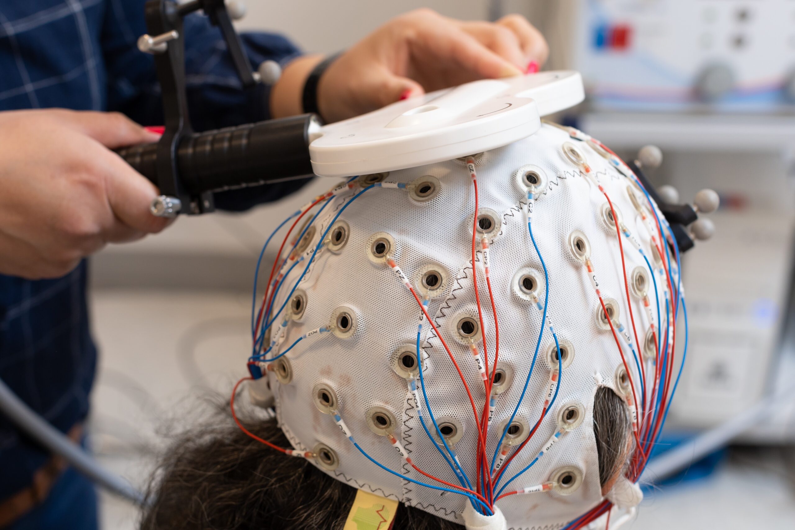 UDD researchers discover that patients recovering from COVID have brain alterations